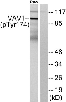Vav1 (phospho Tyr174) rabbit pAb Antibody