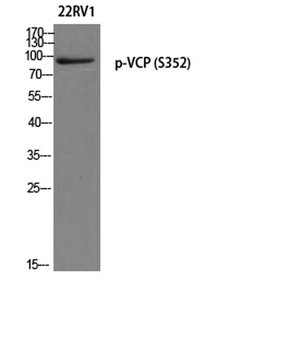 VCP (phospho Ser352) rabbit pAb