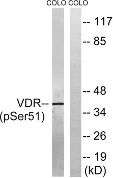 VDR (phospho Ser51) rabbit pAb Antibody