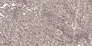 VDR (phospho Ser51) rabbit pAb Antibody