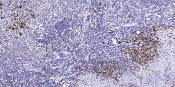 VHL (phospho Ser68) rabbit pAb Antibody