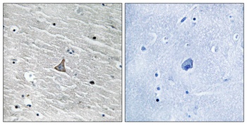 VHL rabbit pAb Antibody