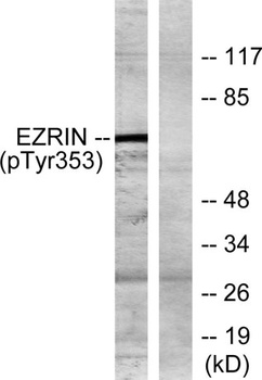 Ezrin (phospho Tyr353) rabbit pAb Antibody