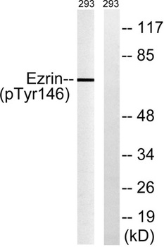 Ezrin (phospho Tyr146) rabbit pAb Antibody