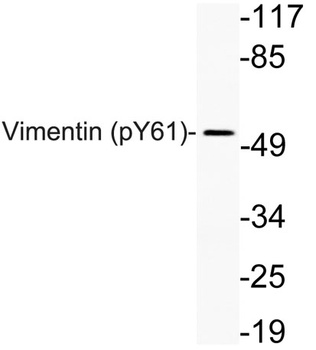 Vimentin (phospho Tyr61) rabbit pAb Antibody