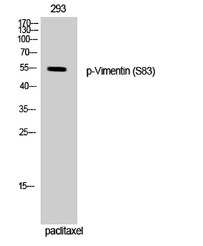 Vimentin (phospho Ser83) rabbit pAb