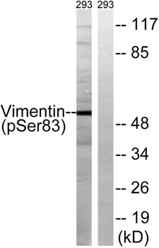 Vimentin (phospho Ser83) rabbit pAb