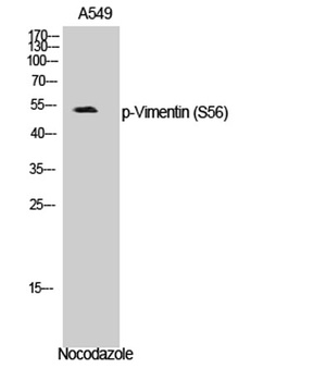Vimentin (phospho Ser56) rabbit pAb Antibody