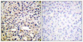 Vimentin (phospho Ser56) rabbit pAb Antibody