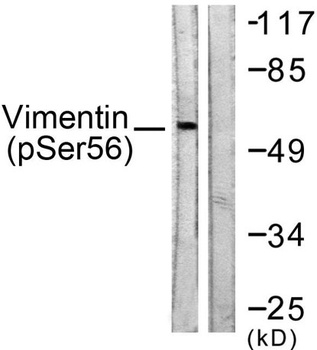 Vimentin (phospho Ser56) rabbit pAb Antibody
