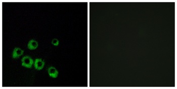 VPAC1 rabbit pAb Antibody