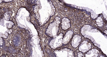 VPAC1 rabbit pAb Antibody