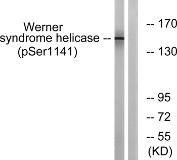 WRN (phospho Ser1141) rabbit pAb Antibody