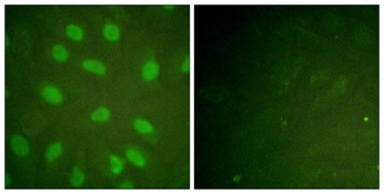 Ku-80 (phospho Thr714) rabbit pAb Antibody