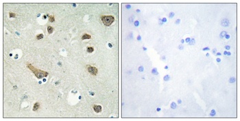 14-3-3 γ rabbit pAb Antibody