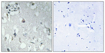 14-3-3 η rabbit pAb Antibody
