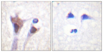 14-3-3 ζ/δ (phospho Thr232) rabbit pAb Antibody