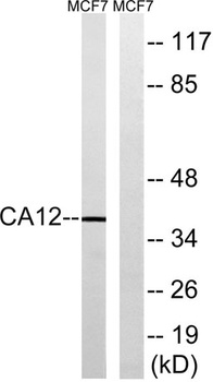CA XII rabbit pAb Antibody