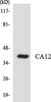 CA XII rabbit pAb Antibody
