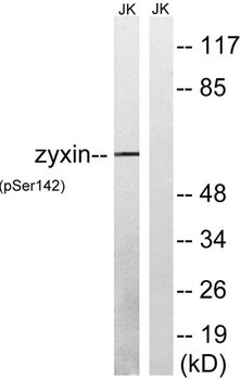 Zyxin (phospho Ser142) rabbit pAb Antibody
