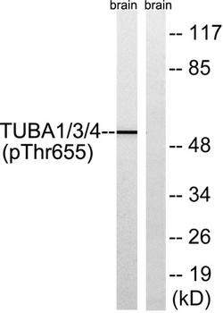Tubulin α1/3/4 (phospho Tyr272) rabbit pAb Antibody