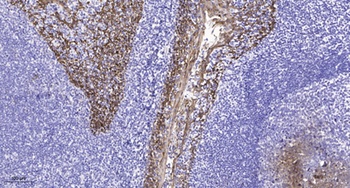 Frizzled-5 rabbit pAb Antibody