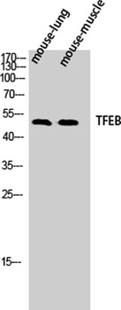 TFEB rabbit pAb Antibody