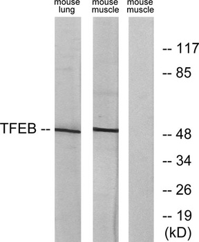 TFEB rabbit pAb Antibody
