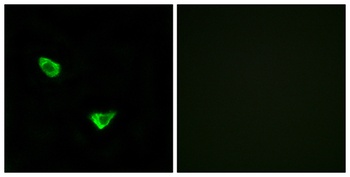 CHSY2 rabbit pAb Antibody