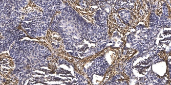 Microcephalin rabbit pAb Antibody