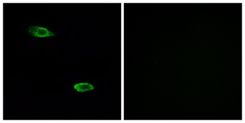 PSGR rabbit pAb Antibody