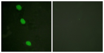 CaMKIV (phospho Thr200) rabbit pAb Antibody