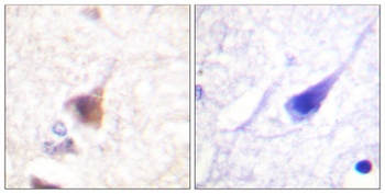 CaMKIV (phospho Thr200) rabbit pAb Antibody