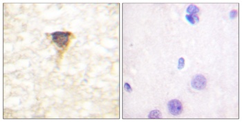 CaMKIV rabbit pAb Antibody