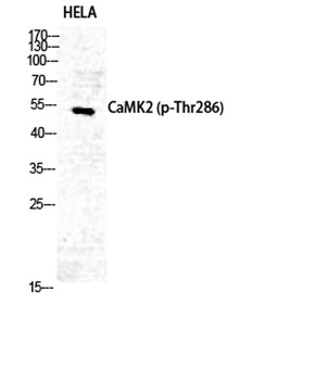 CaMKIIα/δ (phospho Thr286) rabbit pAb Antibody