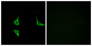 CaMKIIα/δ (phospho Thr286) rabbit pAb Antibody