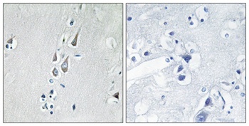 CaMKIIα/δ (phospho Thr286) rabbit pAb Antibody