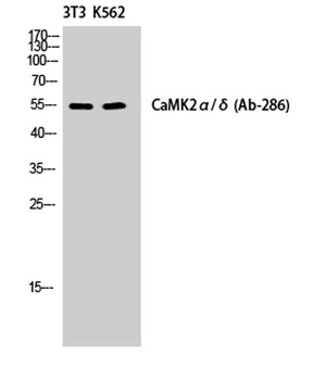 CaMKIIα/δ rabbit pAb Antibody