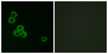 CaMKIIα/δ rabbit pAb Antibody