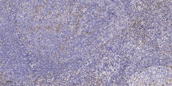 Cables2 rabbit pAb Antibody