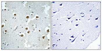 CAF-1 p60 rabbit pAb Antibody