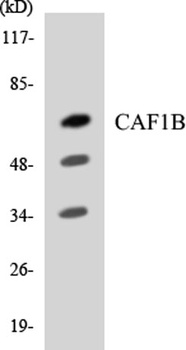 CAF-1 p60 rabbit pAb Antibody