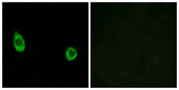 CHST9 rabbit pAb Antibody