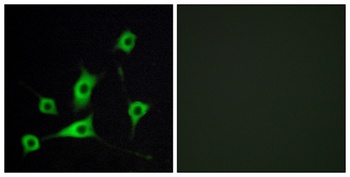 CRBP-III rabbit pAb Antibody