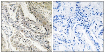 CRBP-III rabbit pAb Antibody