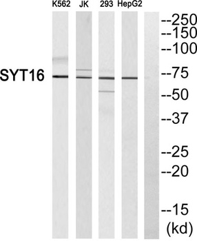 Synaptotagmin XVI rabbit pAb Antibody
