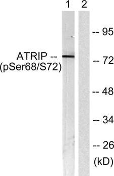 ATRIP (phospho Ser68) rabbit pAb Antibody