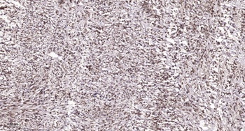 Caspase-9 (phospho Ser196) rabbit pAb Antibody