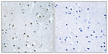 POLDIP3 rabbit pAb Antibody