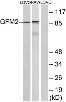 EF-G2 rabbit pAb Antibody